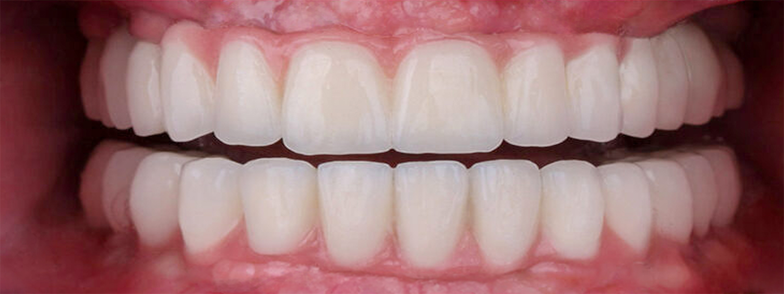 After dental treatment