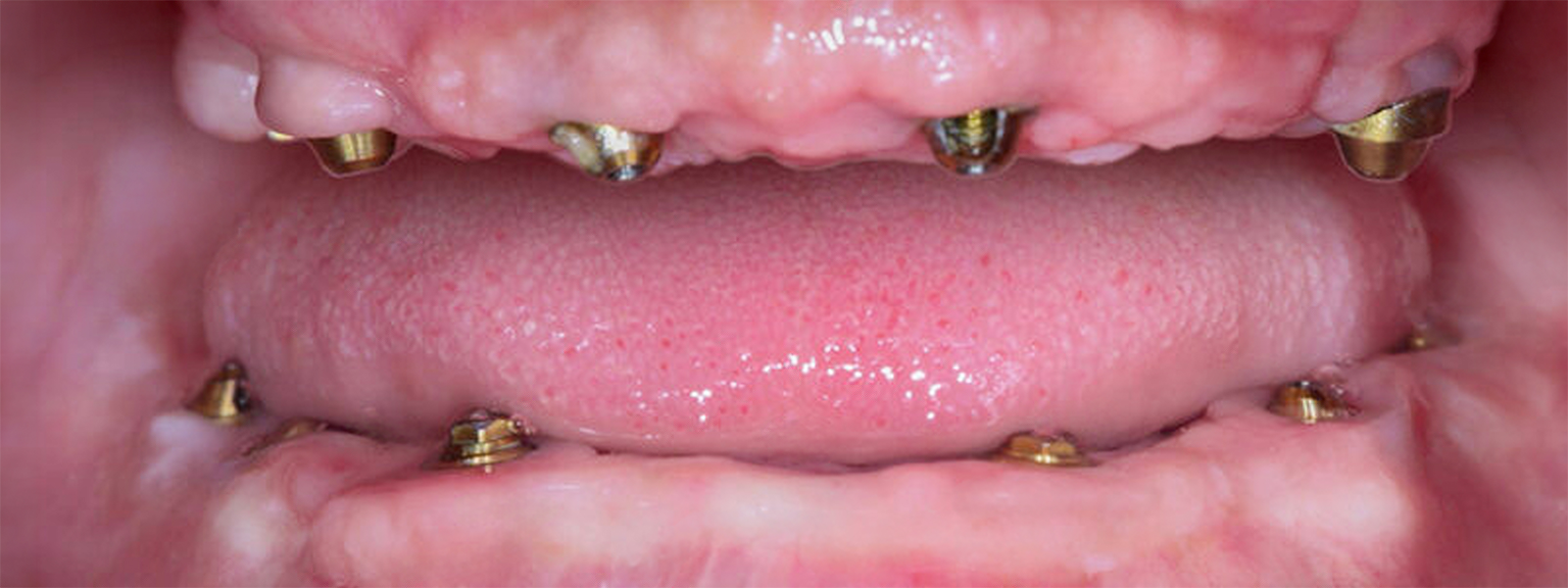 Before dental treatment